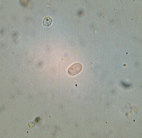 Hyphoderma sambuci